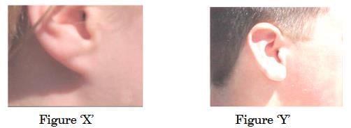 Previous Year Questions 2025