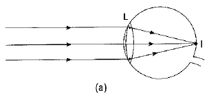 Previous Year Questions 2017